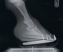 1. Röntgenbild vom 11. November 2008