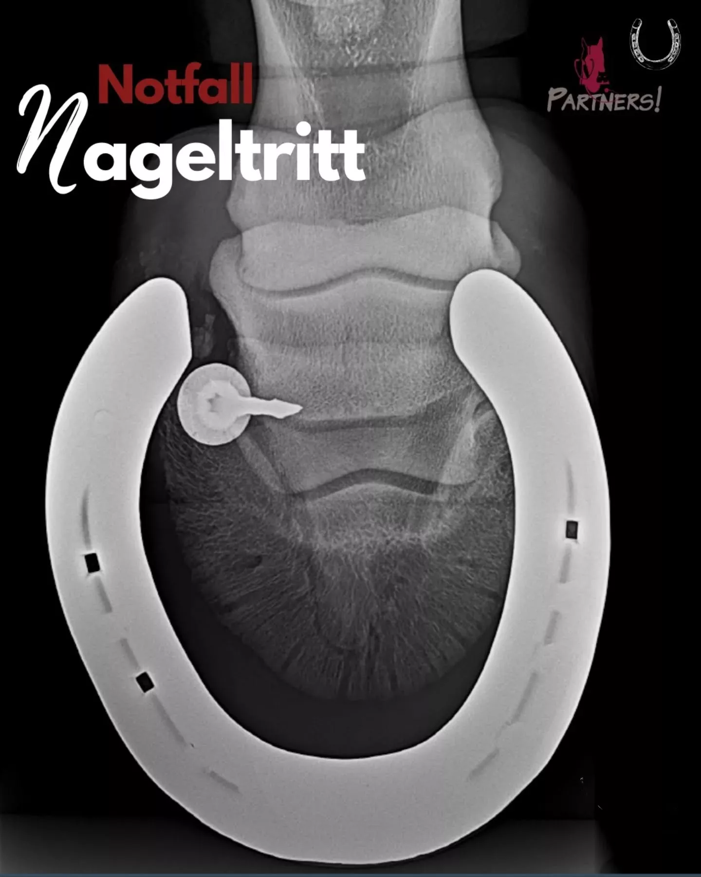 Notfall Nageltritt Notfall Nageltritt